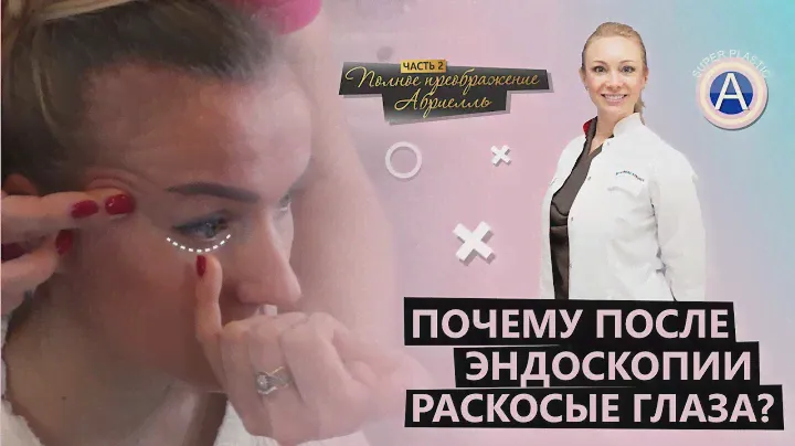 Эндоскопическая подтяжка. Комплексное омоложение лица
