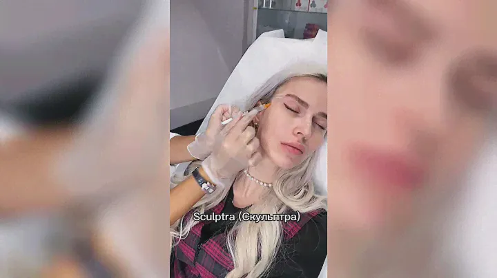 Подтяжка бровей без операции